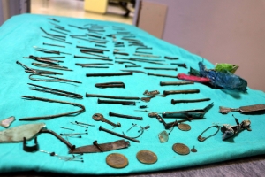 Midesinden çivi, bıçak, tırnak makası gibi 158 parça metal çıkarıldı(Galeri)