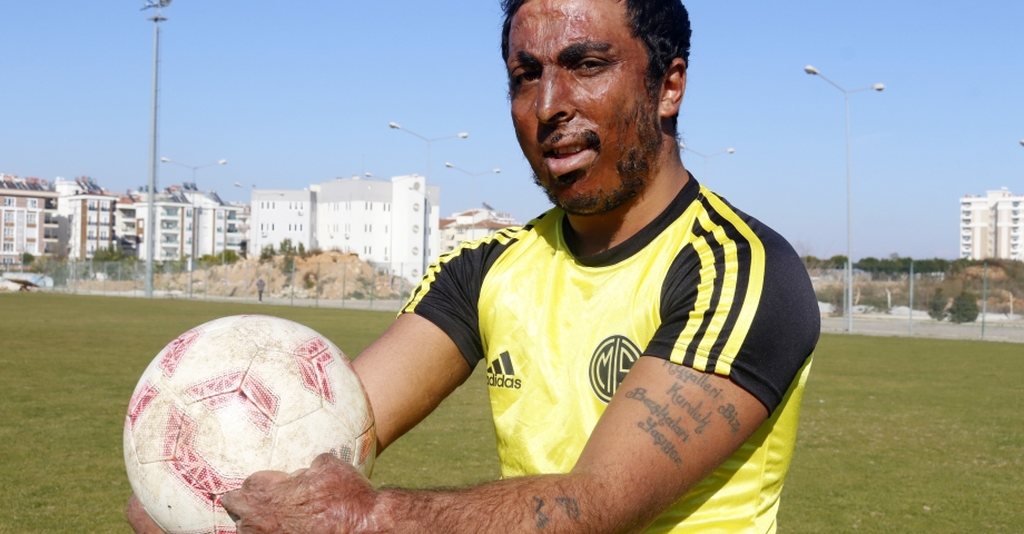 Kardeşinin öldüğü yangında yüzde 84 engelli hale geldi, futbolla hayata tutundu