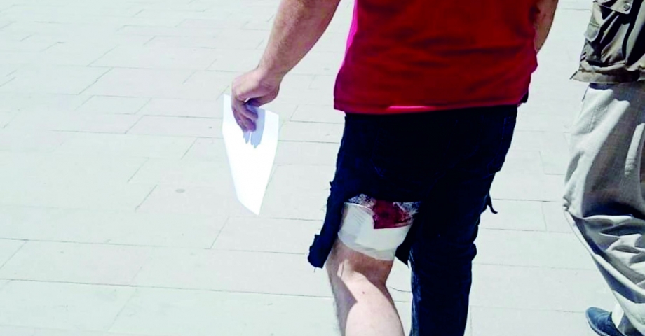 Servis için gittiği evin önünde köpek saldırdı, bacağından yaralandı