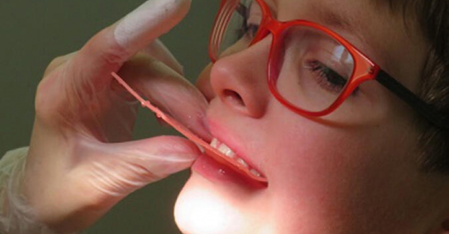 Uzmanı uyardı: Çocuklarda çürüyen süt dişlerinin takibi yapılmalı 
