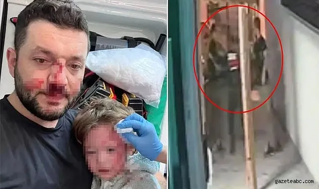 Komşu Kavgası: Baba ve Bebek Darp Edildi
