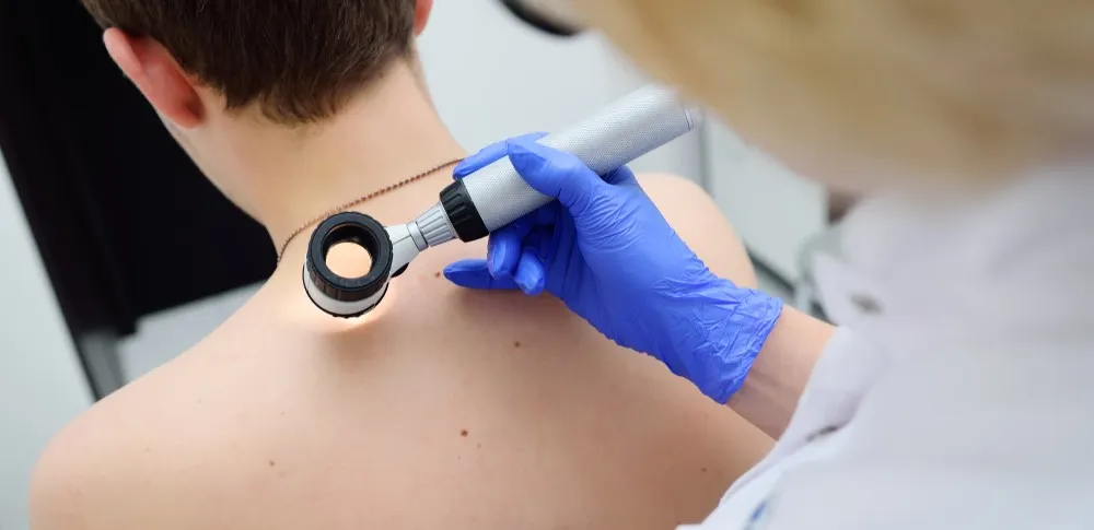 37 ilde ücretsiz deri taraması başladı: Çocuklar öncelikli hedefte