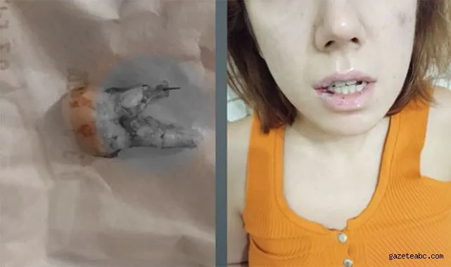 Kanal Tedavisinde Şok İddia