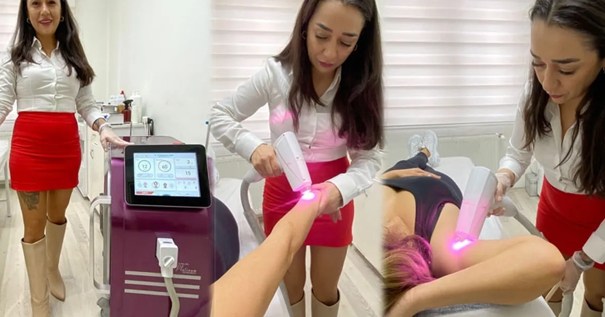 Lazer epilasyonda ten rengine göre yöntem