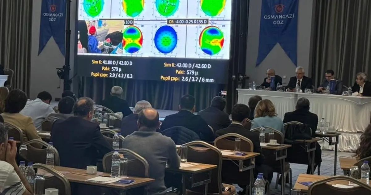 Bursa’da 50 profesörden canlı göz ameliyatı şovu
