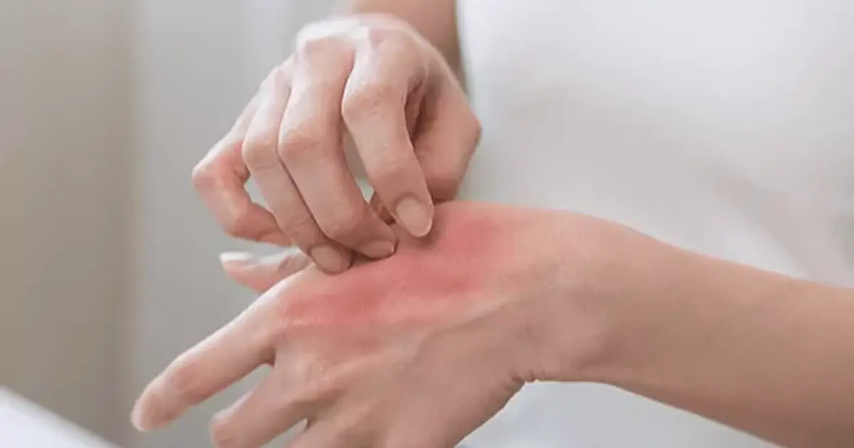 Kaşıntı yalnızca bir cilt sorunu olarak ele alınmamalı!